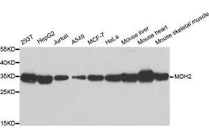 Western Blotting (WB) image for anti-Malate Dehydrogenase 2, NAD (Mitochondrial) (MDH2) antibody (ABIN1980313)