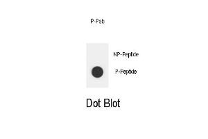 Dot blot analysis of Phospho-ERBB2- Phospho-specific Pab (ABIN1881304 and ABIN2850444) on nitrocellulose membrane. (ErbB2/Her2 antibody  (pTyr1112))