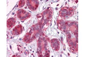 Anti-ENO1 antibody IHC of human breast.