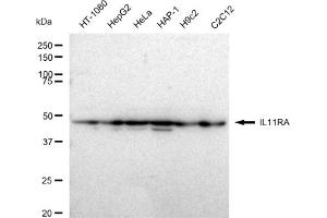 Western blotting analysis using IL11RA antibody (ABIN7799097).
