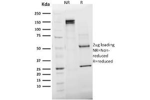 SDS-PAGE (SDS) image for anti-Emerin (EMD) (AA 56-167) antibody (ABIN6939304)