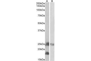 AP22426PU-N DCTN3 antibody staining of Mouse (A) and Rat (B) Skeletal Muscle lysates at 0.