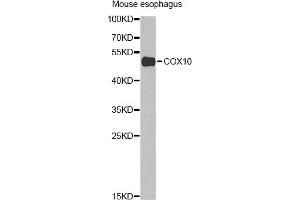 Western blot analysis of extracts of mouse esophagus, using COX10 Antibody (ABIN2561967) at 1:1000 dilution.