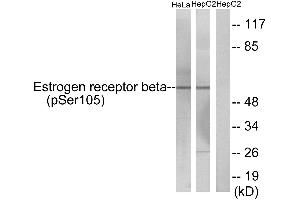 Western blot analysis of extracts from HeLa cells and HepG2 cells, using Estrogen Receptor-β (Phospho-Ser105) antibody. (ESR2 antibody  (pSer105))