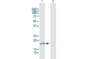 Western Blot analysis of DUSP22 expression in transfected 293T cell line by DUSP22 MaxPab polyclonal antibody. (DUSP22 antibody  (AA 1-184))