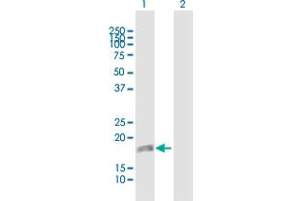 DUSP22 antibody  (AA 1-184)