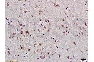Formalin-fixed and paraffin embedded: rat brain tissue labeled with Anti-Nogo-R Polyclonal Antibody (ABIN725420), Unconjugated at 1:200 followed by conjugation to the secondary antibody and DAB staining (RTN4R antibody  (AA 151-350))