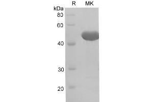 Western Blotting (WB) image for Carcinoembryonic Antigen-Related Cell Adhesion Molecule 1 (CEACAM1) (Active) protein (His tag) (ABIN7321298) (CEACAM1 Protein (His tag))
