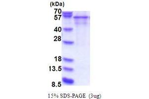 serpin Peptidase Inhibitor, Clade D (Heparin Cofactor), Member 1 (SERPIND1) (AA 58-499) protein (His tag)