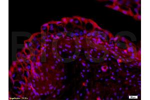 Formalin-fixed and paraffin embedded rabbit bladder tissue labeled with Rabbit Anti-EpCAM/CD326 Polyclonal Antibody (ABIN670611), Unconjugated at 1:200 followed by conjugation to the secondary antibody and DAB staining. (EpCAM antibody  (AA 53-150))