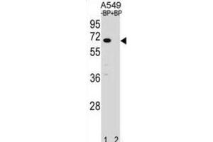 Western Blotting (WB) image for anti-Ankyrin Repeat and SOCS Box-Containing 3 (ASB3) antibody (ABIN2998967)