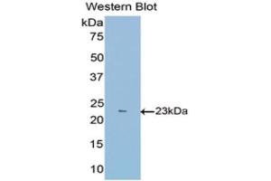 Western Blotting (WB) image for anti-Fibulin 1 (FBLN1) (AA 399-578) antibody (ABIN1175705)