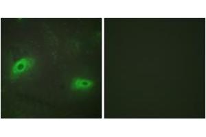 Immunofluorescence analysis of HeLa cells, using TNFSF9 Antibody. (TNFSF9 antibody  (AA 31-80))