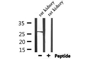 Western blot analysis of extracts from rat kidney, using TNFSF12 Antibody. (TWEAK antibody  (N-Term))