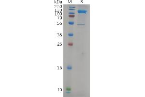 Human Protein, His Tag on SDS-PAGE under reducing condition.