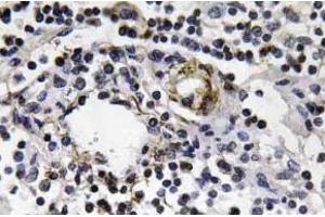 Immunohistochemistry (IHC) analyzes of IFN-gamma antibody in paraffin-embedded human lymph node tissue. (Interferon gamma antibody)