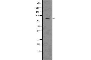 Western blot analysis Nephrin using mouse kidney tissue lysates (Nephrin antibody)