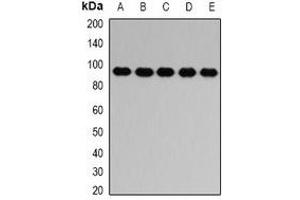Western blot analysis of PTP epsilon expression in HL60 (A), SW620 (B), mouse brain (C), mouse spleen (D), rat lung (E) whole cell lysates. (PTPRE antibody)