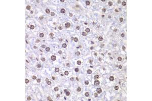 Immunohistochemistry of paraffin-embedded mouse liver using TOP1 antibody at dilution of 1:100 (400x lens).