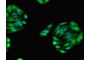 Immunofluorescent analysis of HepG2 cells using ABIN7154159 at dilution of 1:100 and Alexa Fluor 488-congugated AffiniPure Goat Anti-Rabbit IgG(H+L) (GPD1 antibody  (AA 1-349))