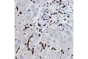 Immunohistochemistry of paraffin-embedded human liver using L-Plastin/LCP1 Rabbit mAb (ABIN7268317) at dilution of 1:100 (40x lens). (LCP1 antibody)