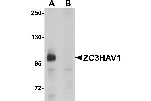 Western Blotting (WB) image for anti-Zinc Finger CCCH-Type, Antiviral 1 (ZC3HAV1) (C-Term) antibody (ABIN1030817) (ZC3HAV1 antibody  (C-Term))