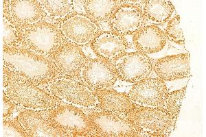 ABIN6263424 and ABIN6269252 at 1/100 staining Rat testis tissue by IHC-P. (MTOR antibody  (C-Term))