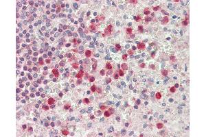 Anti-SERPINB1 antibody IHC staining of human spleen, neutrophils. (SERPINB1 antibody  (AA 130-143))