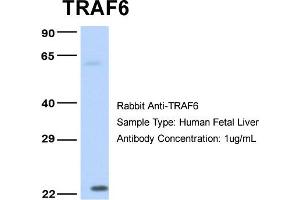 Host: Rabbit Target Name: TRAF6 Sample Type: Human Fetal Liver Antibody Dilution: 1.