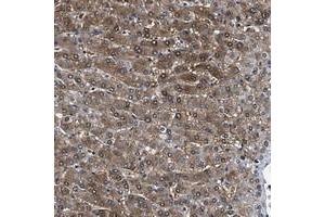 Immunohistochemical staining of human liver with MOV10L1 polyclonal antibody  shows moderate cytoplasmic and nuclear positivity in hepatocytes. (MOV10L1 antibody)