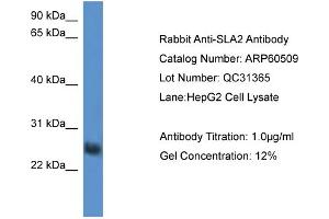 WB Suggested Anti-SLA2  Antibody Titration: 0. (SLAP2 antibody  (Middle Region))