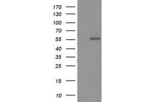 HEK293T cells were transfected with the pCMV6-ENTRY control (Left lane) or pCMV6-ENTRY TP53 (Right lane) cDNA for 48 hrs and lysed. (p53 antibody)