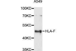 Western blot analysis of extracts of A-549 cells, using HLA-F antibody (ABIN5997910) at 1/1000 dilution.