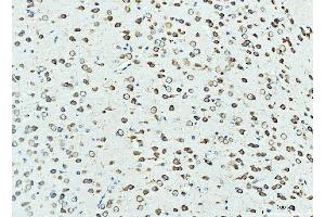 IHC analysis of RPL23 using anti-RPL23 antibody (ABIN7599808). (RPL23 antibody  (AA 12-136))