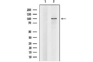 anti-Zinc Fingers and Homeoboxes 1 (ZHX1) (N-Term) antibody