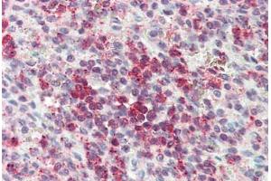 Anti-CYSLTR2 / CYSLT2 antibody  ABIN1048490 IHC staining of human spleen.