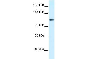 WB Suggested Anti-KCNH3 Antibody Titration: 1. (KCNH3 antibody  (N-Term))