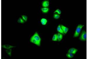Immunofluorescence staining of Hela Cells with ABIN7127769 at 1:50, counter-stained with DAPI. (Recombinant PKM antibody)