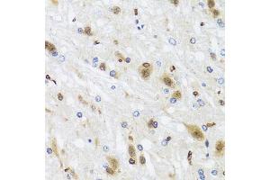 Immunohistochemistry of paraffin-embedded rat brain using HDAC4 antibody (ABIN4903045) at dilution of 1:100 (40x lens). (TUBB antibody)