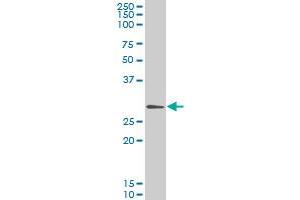 GCLM monoclonal antibody (M01), clone 2B8 Western Blot analysis of GCLM expression in HeLa . (GCLM antibody  (AA 1-274))