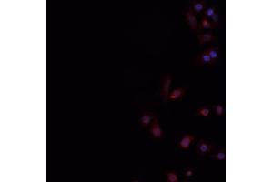 ABIN6266479 staining hela  cells by IF/ICC. (CD226 antibody)