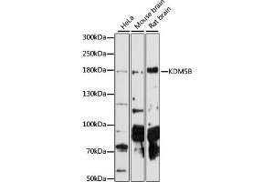 Western blot analysis of extracts of various cell lines, using KDM5B antibody  at 1:1000 dilution. (KDM5B antibody  (AA 784-883))