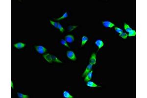 Immunofluorescent analysis of Hela cells using ABIN7156464 at dilution of 1:100 and Alexa Fluor 488-congugated AffiniPure Goat Anti-Rabbit IgG(H+L) (CD11b antibody  (AA 46-150))