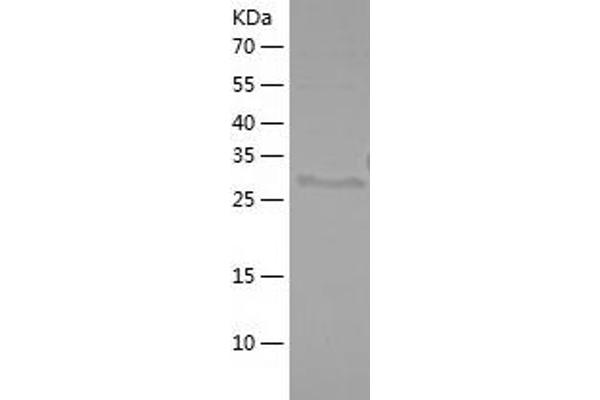 TAF1 Protein (AA 1400-1651) (His tag)