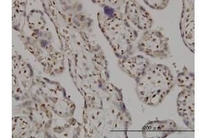 Image no. 1 for anti-SMC6 Structural Maintenance of Chromosomes 6-Like 1 (SMC6) (AA 1-110) antibody (ABIN599304) (SMC6 antibody  (AA 1-110))