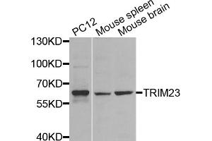 Western blot analysis of extracts of various cell lines, using TRIM23 antibody (ABIN5974665) at 1/1000 dilution. (TRIM23 antibody)