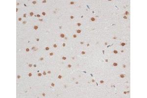 Immunohistochemistry (Paraffin-embedded Sections) (IHC (p)) image for anti-Zinc Finger Protein 148 (ZNF148) antibody (ABIN7262943)