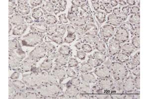Immunohistochemistry (Formalin-fixed Paraffin-embedded Sections) (IHC (fp)) image for anti-RNA Binding Motif Protein 5 (RBM5) (AA 1-546) antibody (ABIN523557)