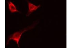 ABIN6277345 staining  MCF7 cells by IF/ICC. (USO1 antibody  (C-Term))