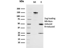 SDS-PAGE Analysis Purified MAGEA4 Mouse Monoclonal Antibody (CPTC-MAGEA4-1). (MAGEA4 antibody)